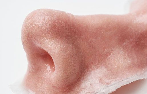 3D-printed-nose