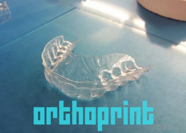 設計系學生 3D 列印自製牙套來矯正牙齒！