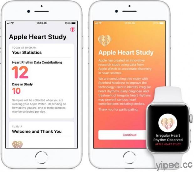Stanford 史丹佛醫學中心發表 Apple 心臟研究成果，心率不整確定率達 84%