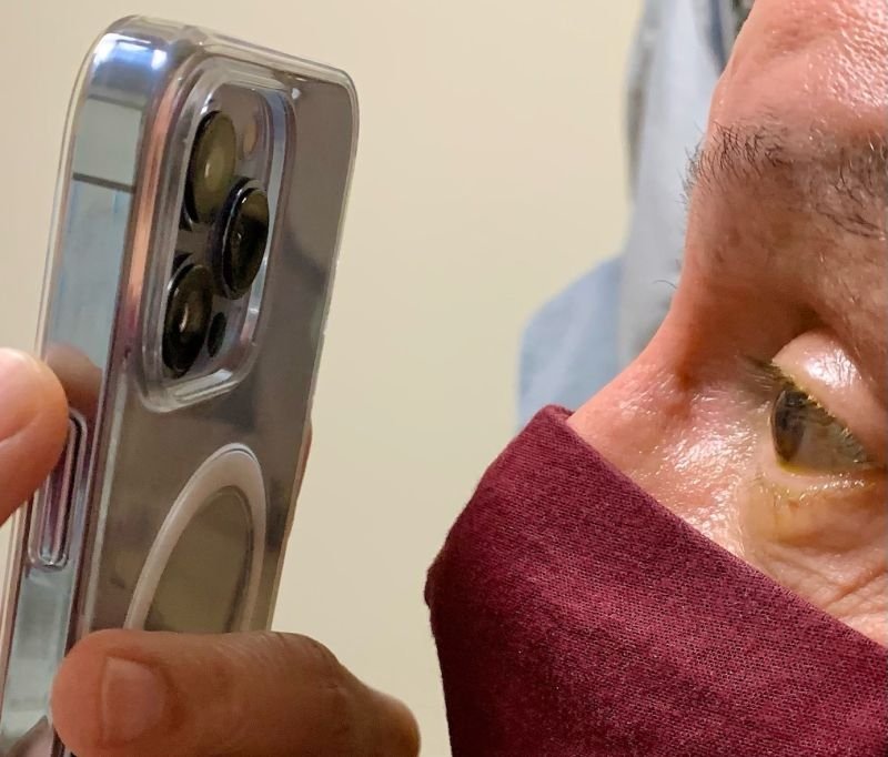 iPhone 13 Pro 微距模式不只能拍照，美國眼科醫生利用它來檢查眼睛！